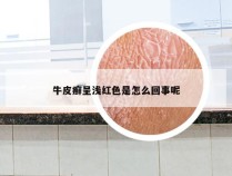 牛皮癣呈浅红色是怎么回事呢