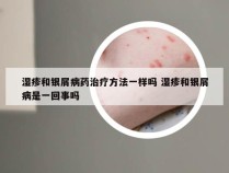 湿疹和银屑病药治疗方法一样吗 湿疹和银屑病是一回事吗