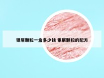 银屑颗粒一盒多少钱 银屑颗粒的配方