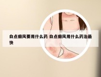 白点癫风要用什么药 白点癫风用什么药治最快