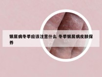 银屑病冬季应该注意什么 冬季银屑病皮肤保养