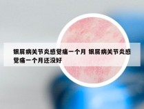 银屑病关节炎感觉痛一个月 银屑病关节炎感觉痛一个月还没好