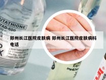 郑州长江医院皮肤病 郑州长江医院皮肤病科电话