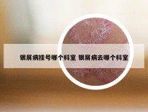 银屑病挂号哪个科室 银屑病去哪个科室