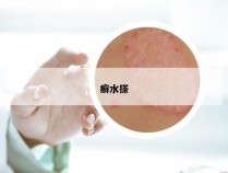 癣水搽