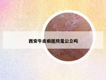 西安牛皮癣医院是公立吗