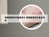 百癣夏塔热片服用多久 百癣夏塔热片多久见效
