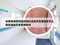 有银屑病想知道我用的这款药膏是激素药么 银屑病用药膏有激素吗