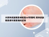 大斑块状副银屑病就是mf早期吗 斑块状副银屑病与银屑病的区别