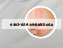 疫情解剖银屑病 疫情解剖银屑病患者
