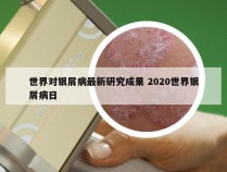 世界对银屑病最新研究成果 2020世界银屑病日