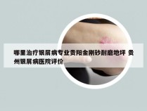 哪里治疗银屑病专业贵阳金刚砂耐磨地坪 贵州银屑病医院评价