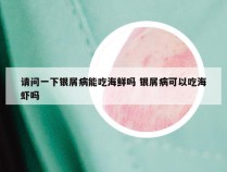 请问一下银屑病能吃海鲜吗 银屑病可以吃海虾吗
