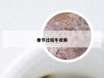 春节过后牛皮癣
