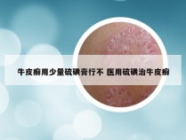 牛皮癣用少量硫磺膏行不 医用硫磺治牛皮癣