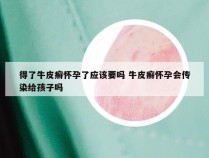 得了牛皮癣怀孕了应该要吗 牛皮癣怀孕会传染给孩子吗