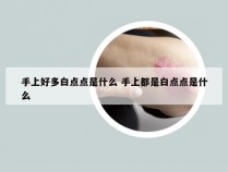 手上好多白点点是什么 手上都是白点点是什么