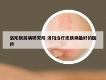 洛阳银屑病研究院 洛阳治疗皮肤病最好的医院