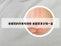 皮癣灵的作用与功效 皮藓灵多少钱一盒