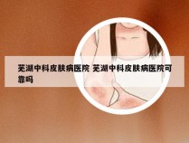 芜湖中科皮肤病医院 芜湖中科皮肤病医院可靠吗