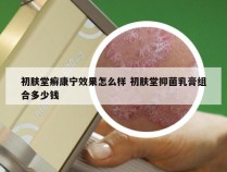 初肤堂癣康宁效果怎么样 初肤堂抑菌乳膏组合多少钱