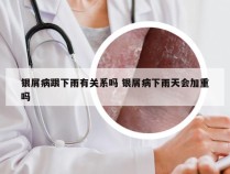 银屑病跟下雨有关系吗 银屑病下雨天会加重吗
