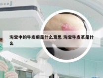 淘宝中的牛皮癣是什么意思 淘宝牛皮革是什么