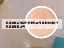 银屑病用生物制剂需要忌口吗 生物制剂治疗银屑病用忌口吗