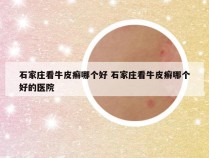 石家庄看牛皮癣哪个好 石家庄看牛皮癣哪个好的医院