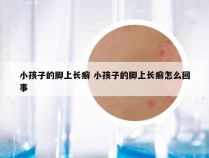 小孩子的脚上长癣 小孩子的脚上长癣怎么回事