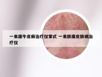 一来康牛皮癣治疗仪掌式 一来肤康皮肤病治疗仪