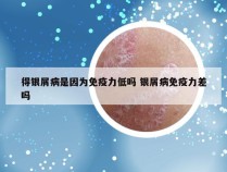 得银屑病是因为免疫力低吗 银屑病免疫力差吗