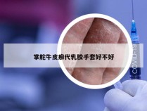 掌舵牛皮癣代乳胶手套好不好