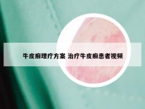 牛皮癣理疗方案 治疗牛皮癣患者视频