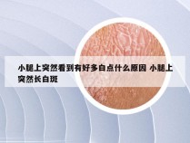 小腿上突然看到有好多白点什么原因 小腿上突然长白斑