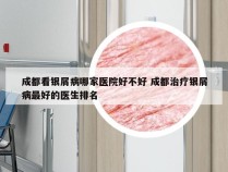 成都看银屑病哪家医院好不好 成都治疗银屑病最好的医生排名