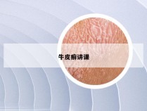 牛皮癣讲课