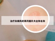 治疗白癜风的草药图片大全和名称