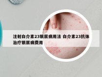 注射白介素23银屑病用法 白介素23抗体治疗银屑病费用
