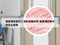 银屑病控制住了会影响确诊吗 银屑病控制不住怎么回事