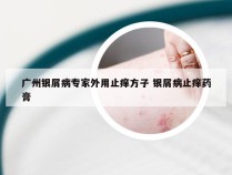 广州银屑病专家外用止痒方子 银屑病止痒药膏