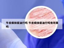 牛皮癣抹柴油行吗 牛皮癣抹柴油行吗有效果吗