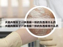 大腿内侧长了一块像癣一样的东西用什么药 大腿内侧长了一块像癣一样的东西痒用什么药