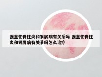 强直性脊柱炎和银屑病有关系吗 强直性脊柱炎和银屑病有关系吗怎么治疗