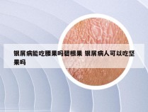 银屑病能吃腰果吗碧根果 银屑病人可以吃坚果吗