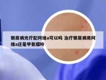 银屑病光疗配阿维a可以吗 治疗银屑病用阿维a还是甲氨蝶呤