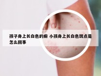 孩子身上长白色的癣 小孩身上长白色斑点是怎么回事