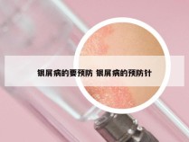 银屑病的要预防 银屑病的预防针