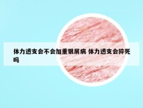体力透支会不会加重银屑病 体力透支会猝死吗
