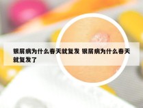 银屑病为什么春天就复发 银屑病为什么春天就复发了
